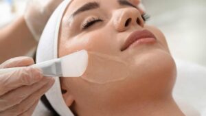peeling chimique